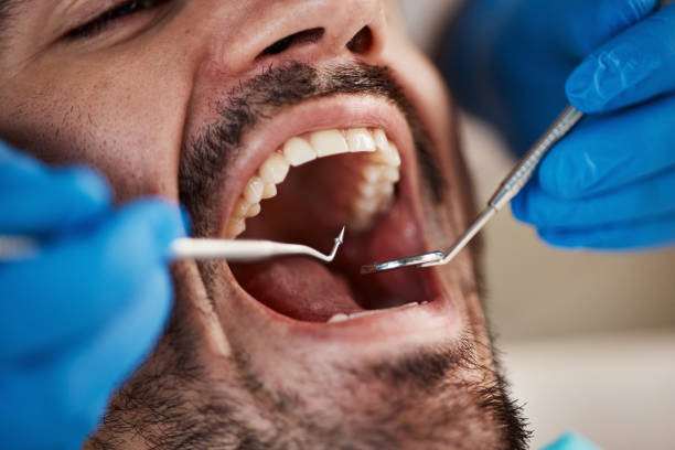 Best Emergency Care for Gum Disease in St Louis, MI