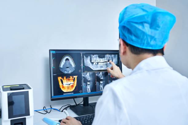 Best Emergency Wisdom Tooth Extraction in St Louis, MI
