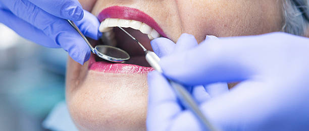 Best Emergency Care for Gum Disease in St Louis, MI